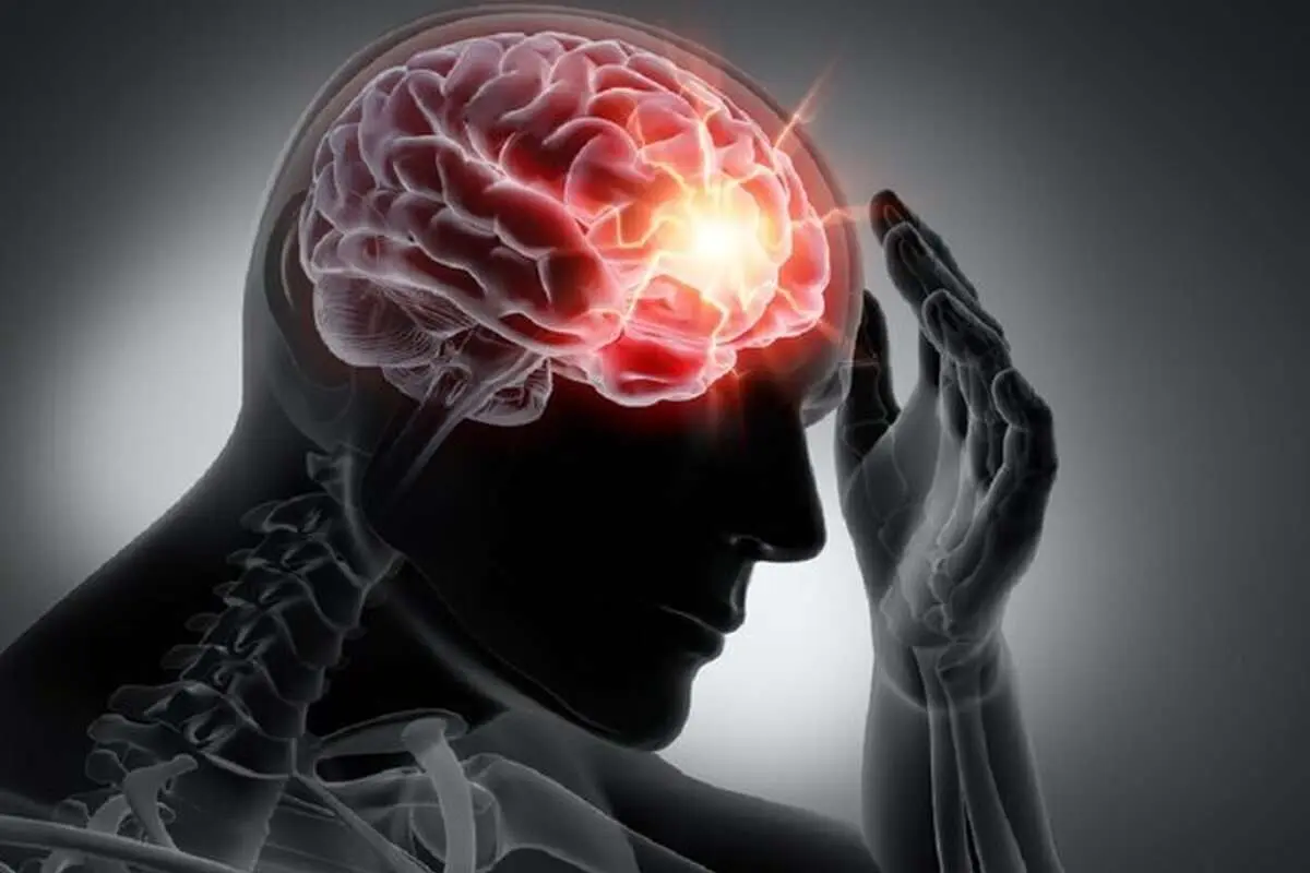 پنج عامل تحریککننده سردرد