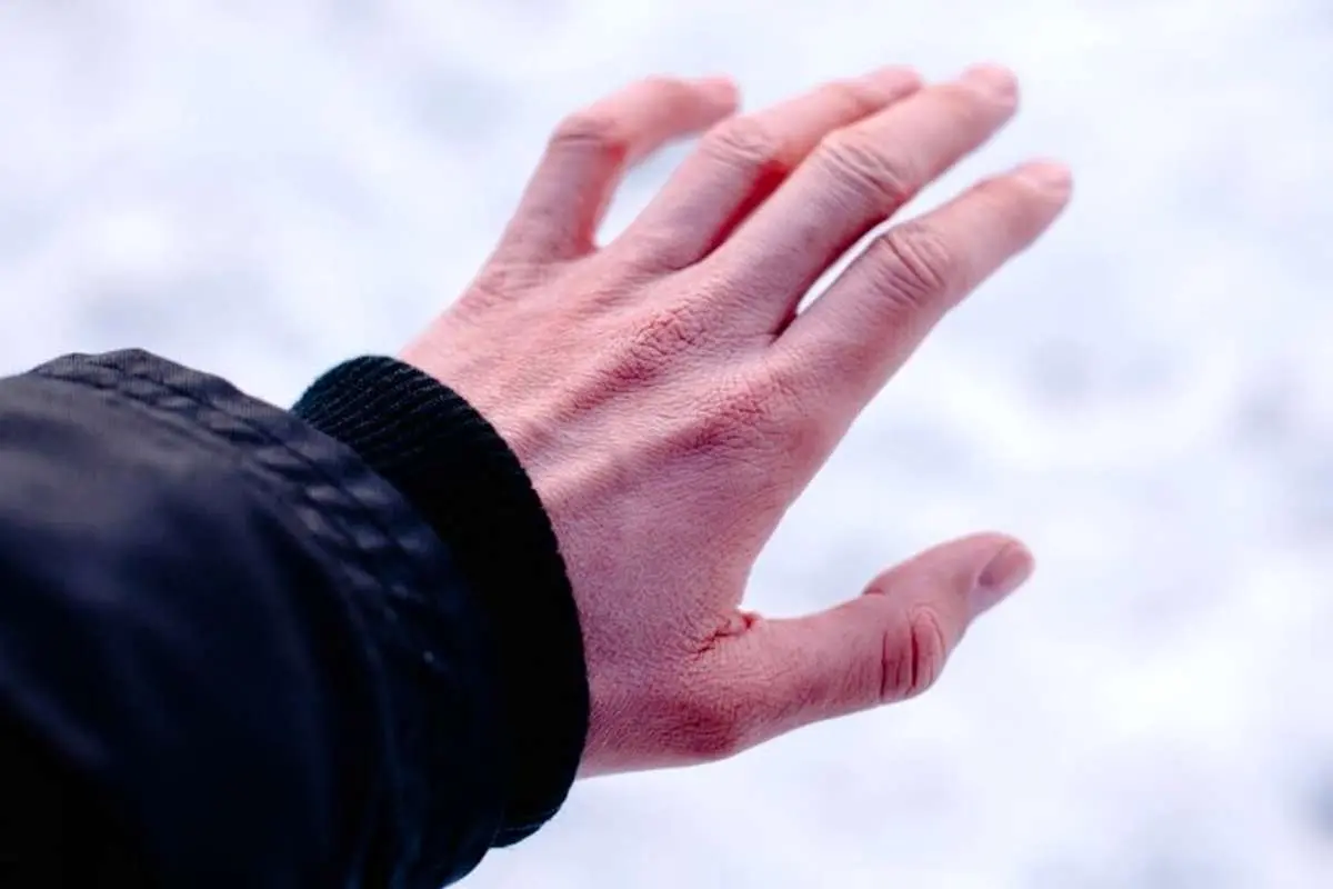 چگونه به فرد سرما زده کمک کنیم؟