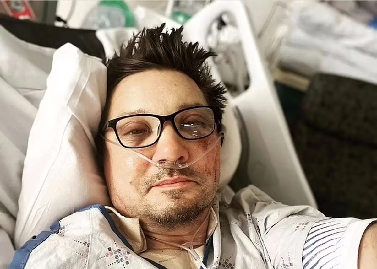 (عکس) وخامت اوضاع ستاره هالیوود پس از حادثه اخیر