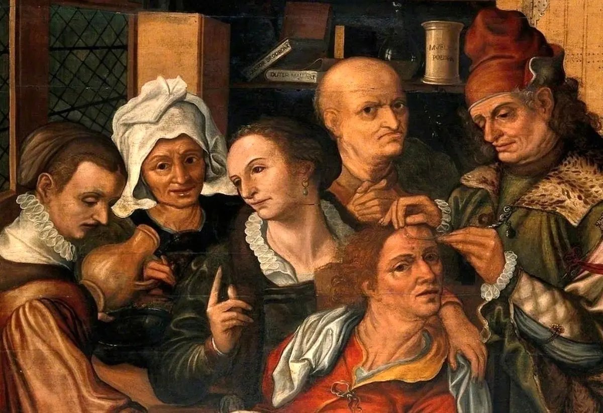 مته‌کاری؛ یک راهکار هولناک باستانی برای درمان مغز و اعصاب