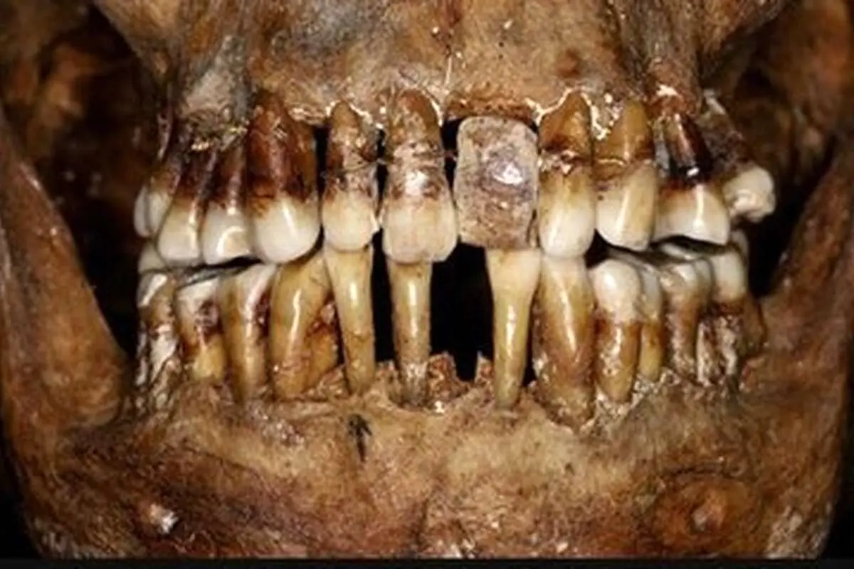 افشای راز دردناک زن اشرافزاده پس از ۴ قرن