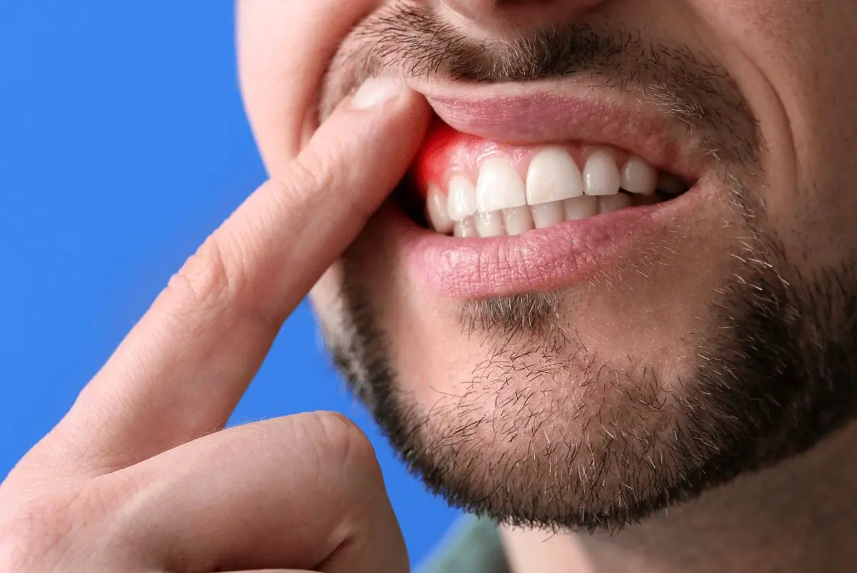 چرا هنگام مسواک زدن از لثه خون می‌آید؟