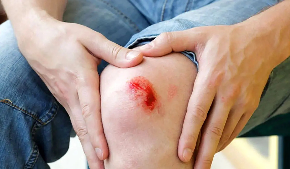 چرا جای زخم روی پوست باقی می‌ماند؟