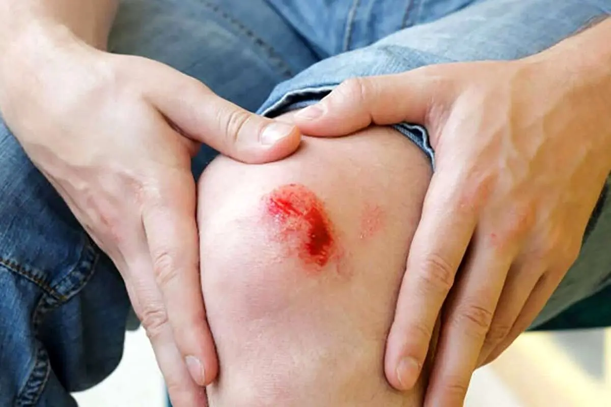 چرا جای زخم روی پوست باقی میماند؟