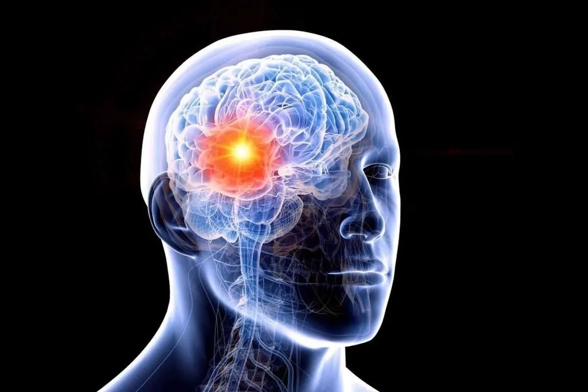 (ویدئو) پیشرفت عجیب علم؛ جراحی تومور بزرگ مغزی از راه بینی در ساری