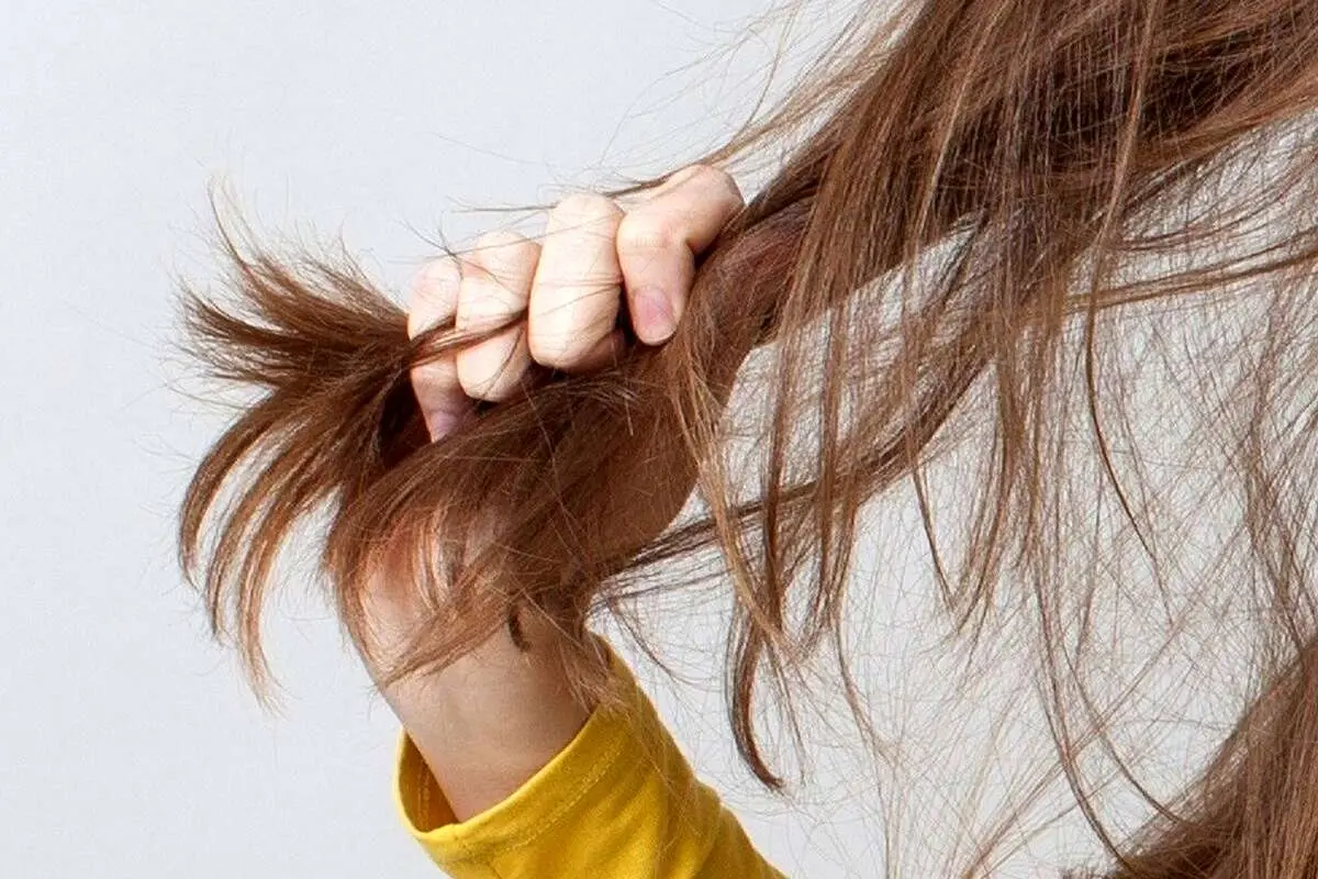 علت موخوره چیست؟/ قاتل موخوره و بهترین درمان موخوره را بشناسید