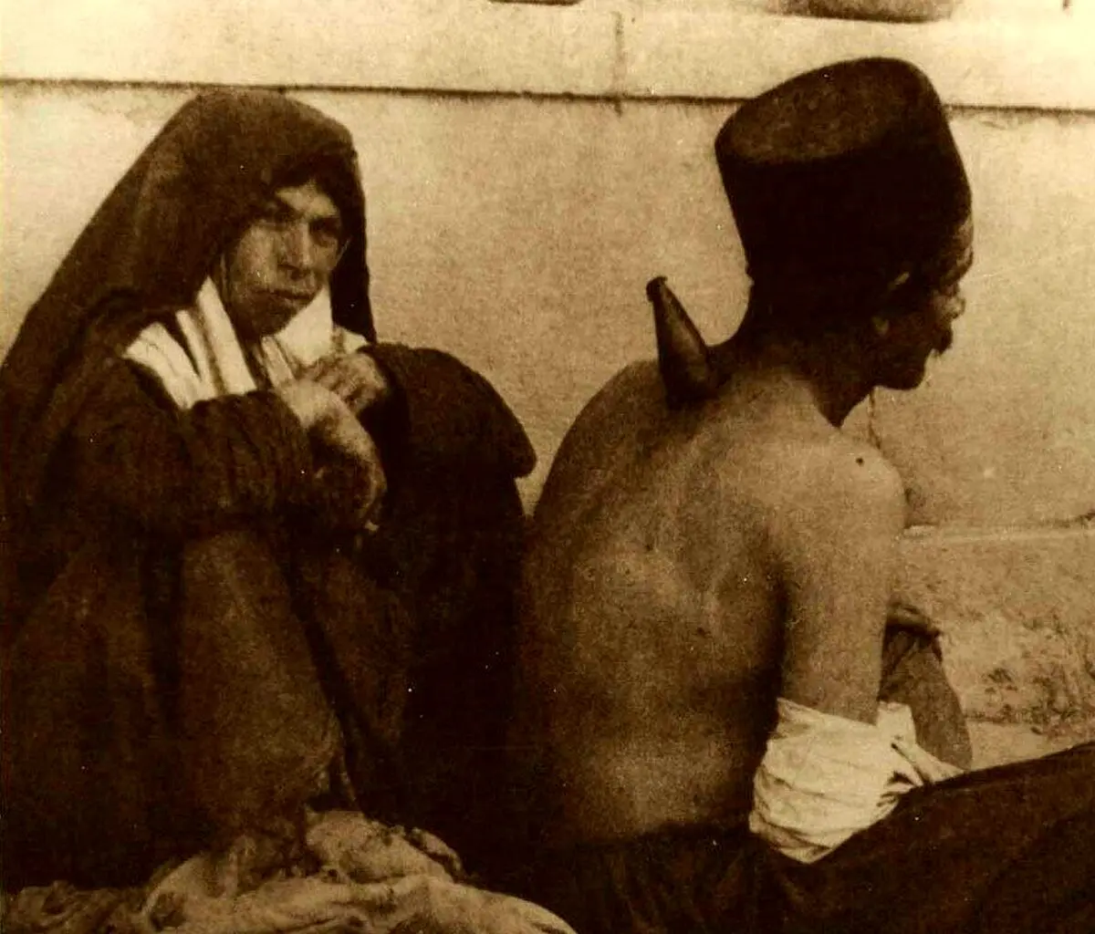 حجامت با شاخ گاو در تهران قدیم!