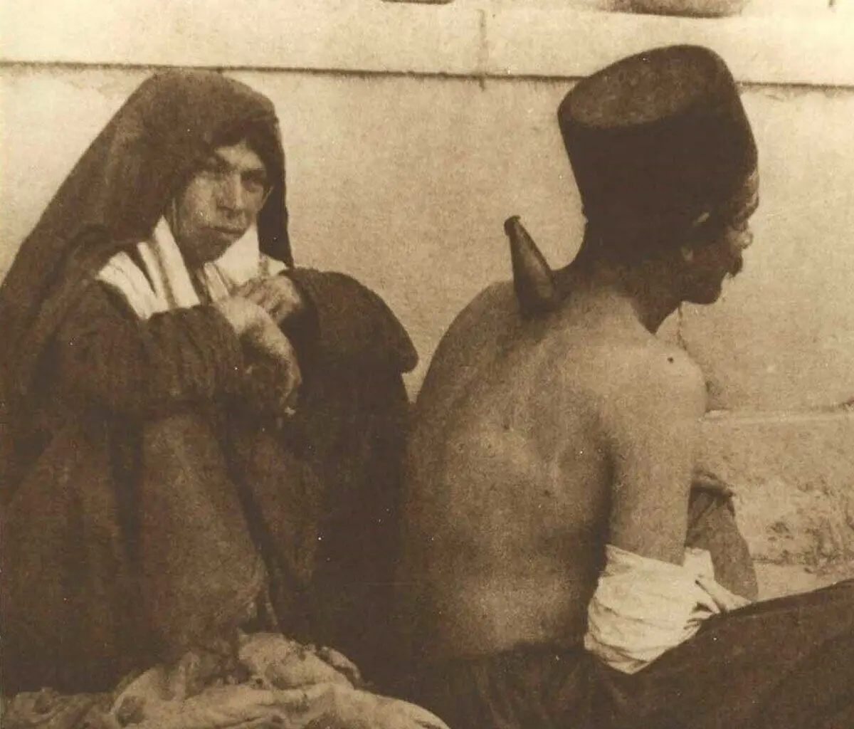 حجامت با شاخ گاو در تهران قدیم!