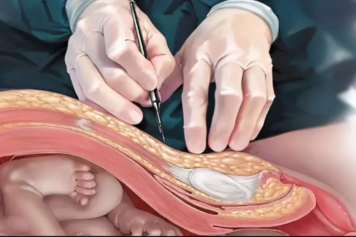 (ویدئو) پشت‌پرده ویدیوی جنجالی «مزرعه رحم انسان»!