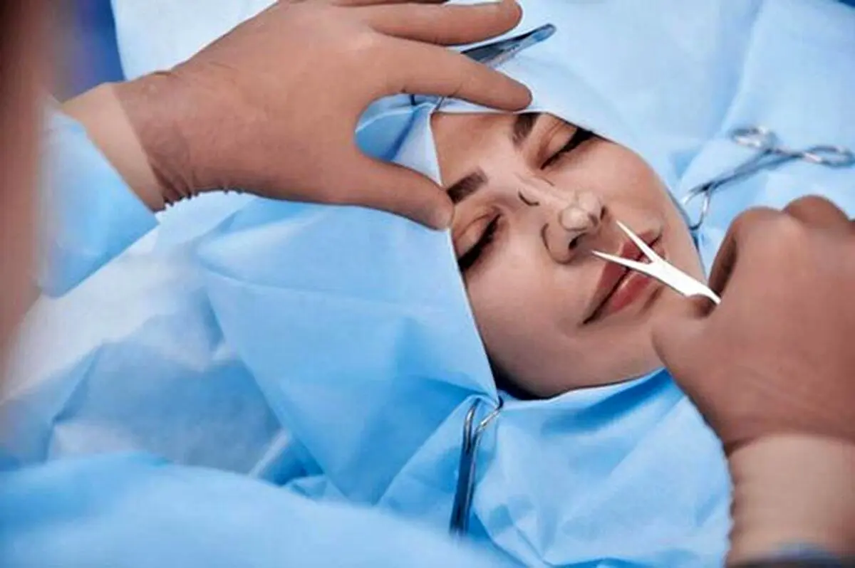 (ویدئو) چرا نباید در ١٧ سالگی بینی‌تان را جراحی کنید؟