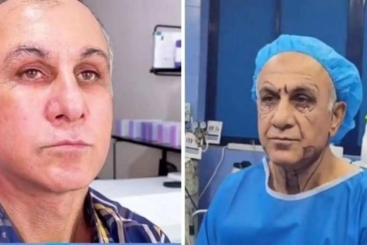 (ویدئو) پیرمردی که با انجام جراحی زیبایی جوان شد!
