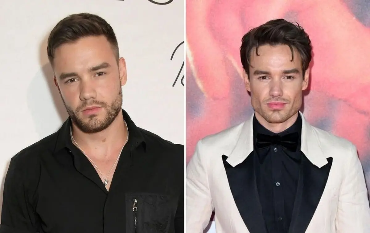 (عکس) تغییر چهره خواننده مشهور همه را شوکه کرد!