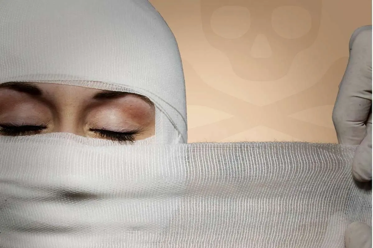 اسیدپاشی همسر سابق به زن جوان و دختر ۴ ساله اش در تهران