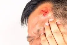ضربه و آسیب به سر