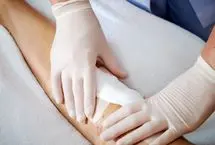 عفونت زخم جراحی