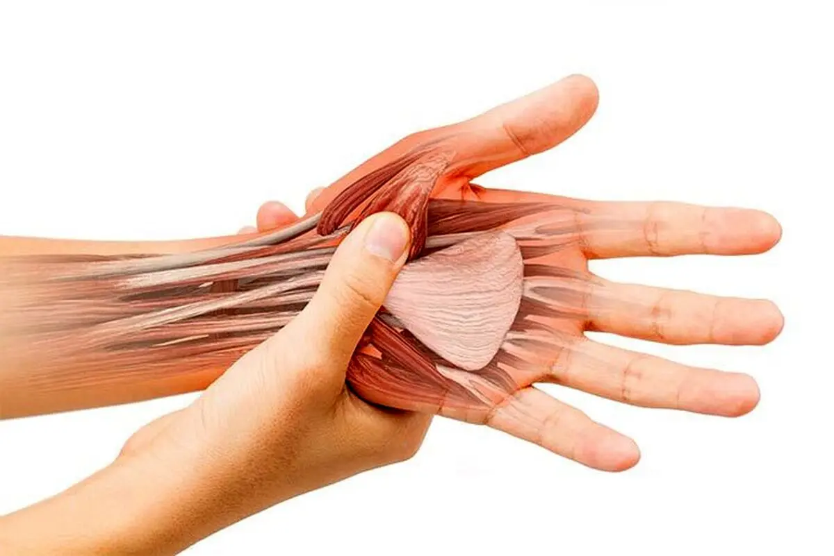 تاندونیت و تنوسینوویت: علل، علائم و روش‌های درمان