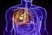 بیماری انسداد ریوی مزمن (COPD)