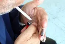 بیماری برگر (ترومبوآنژئیت انسدادی)