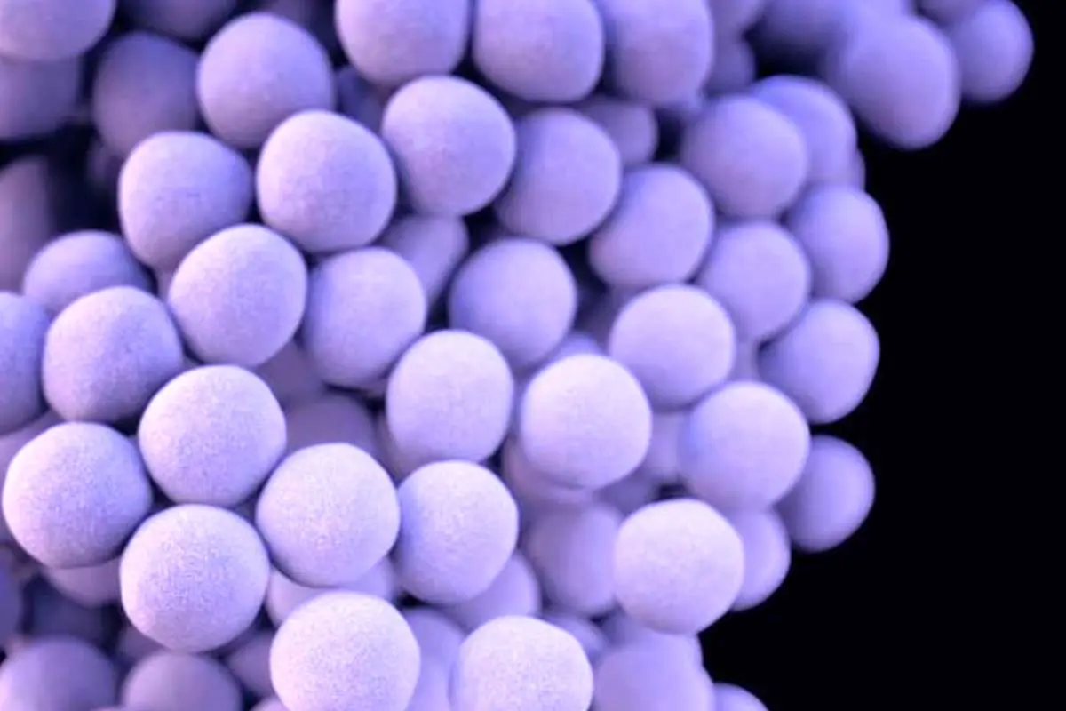 علائم مسمومیت غذایی استافیلوکوکوس اورئوس