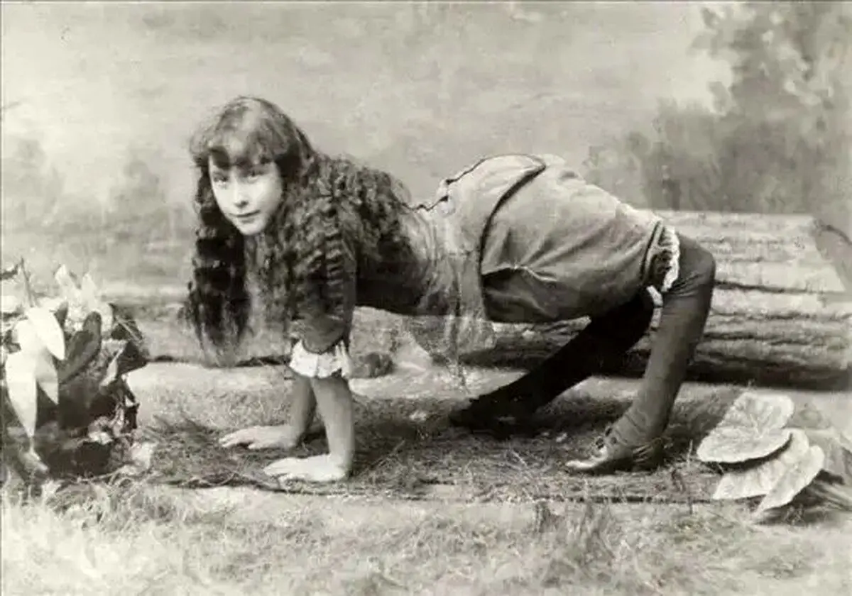 (عکس) راز «دختر شتری» که دنیا را در بهت فرو برد!