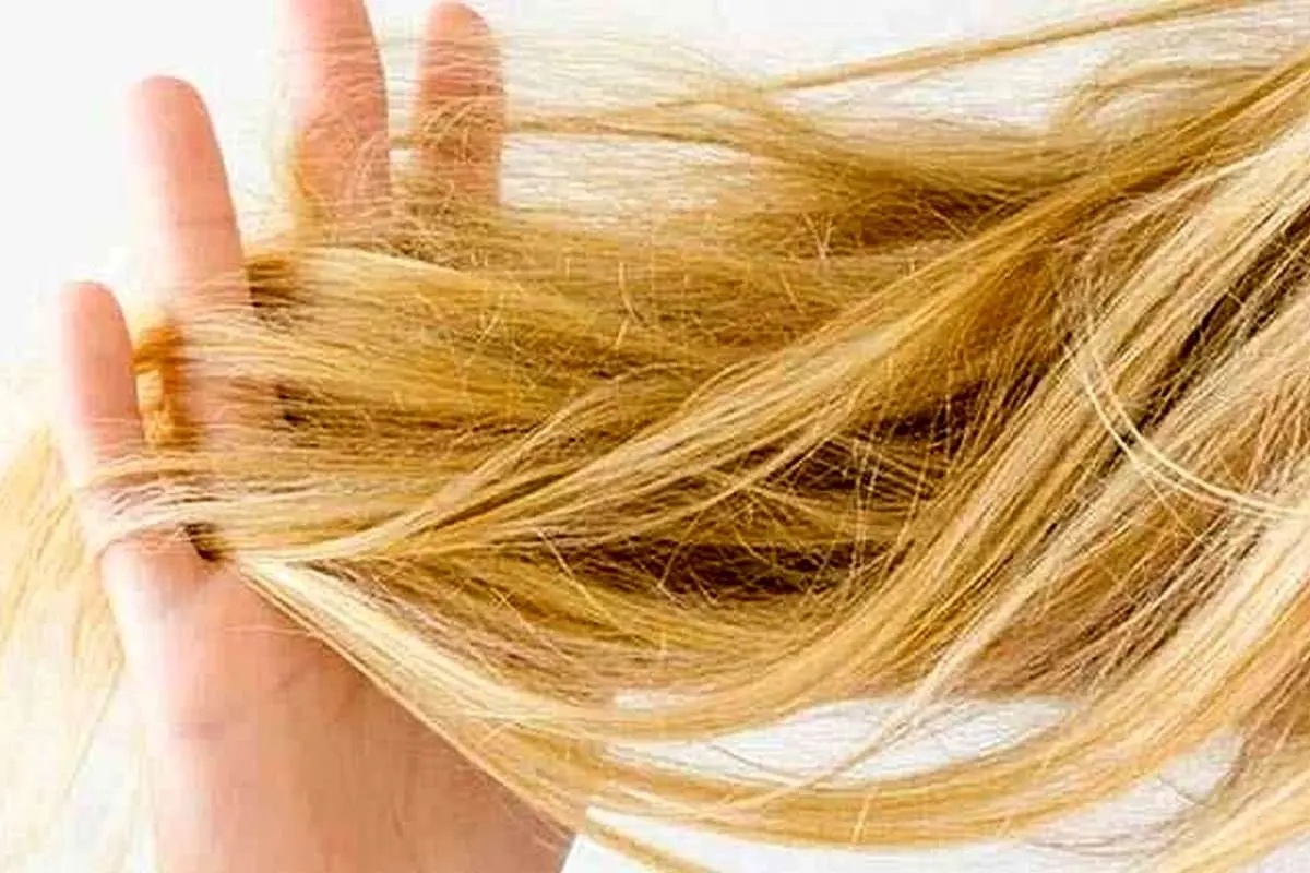 چرا موهای من همیشه خشک و شکننده است؟