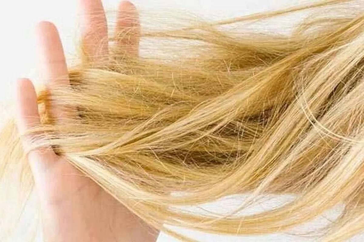 چرا موهای من همیشه خشک و شکننده است؟