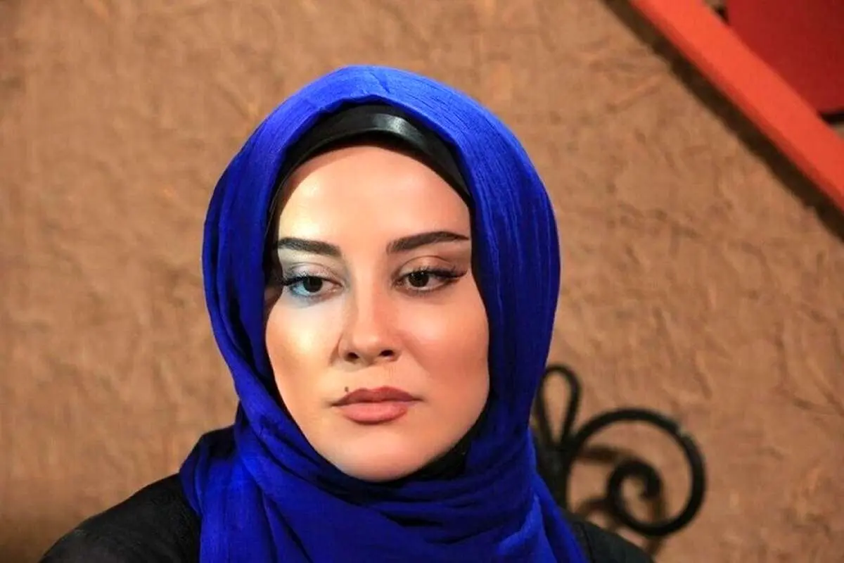 (عکس) چهره خانم بازیگر پس از عمل جراحی