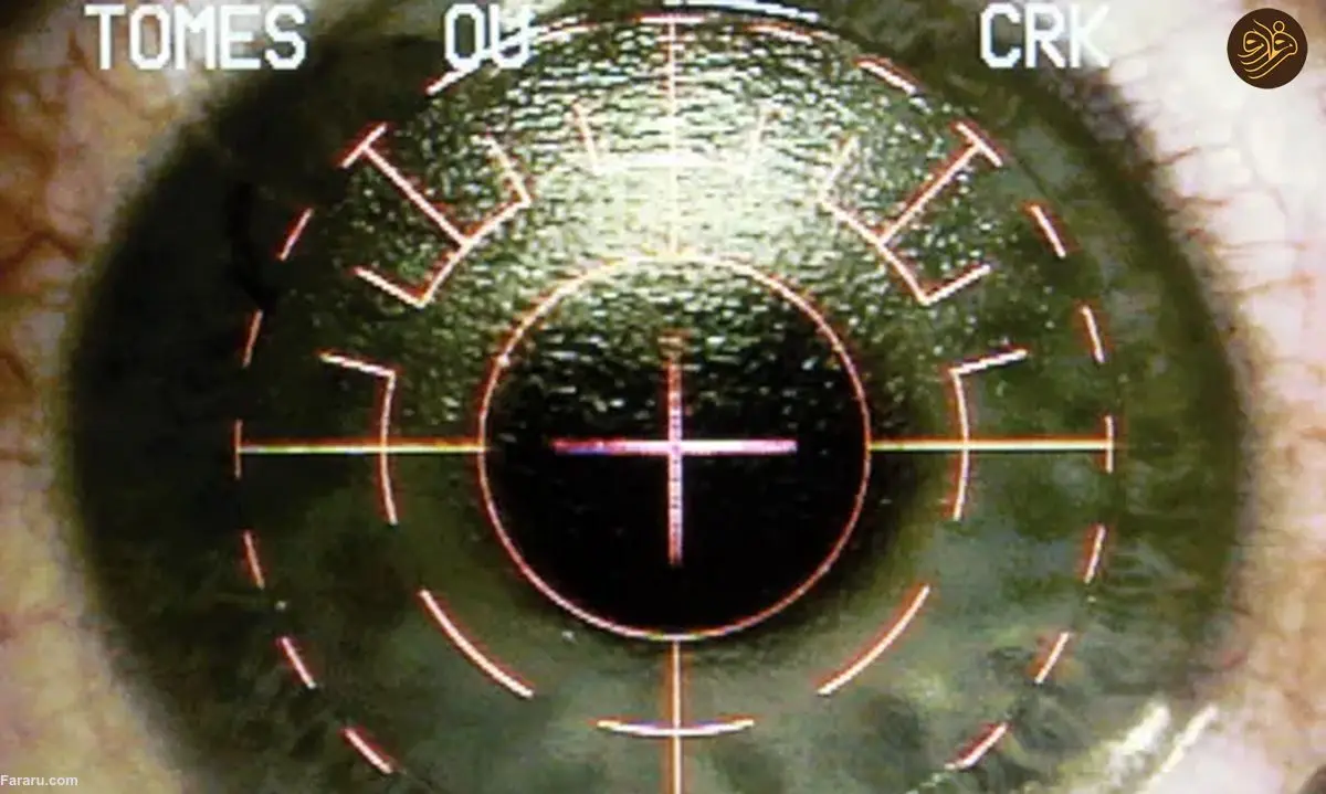 بیمارانی که از جراحی لیزر چشم پشیمان هستند: زندگی من از آن زمان متوقف شده است