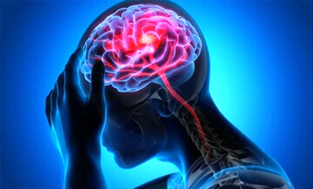 چگونه از سکته مغزی جلوگیری کنیم؟