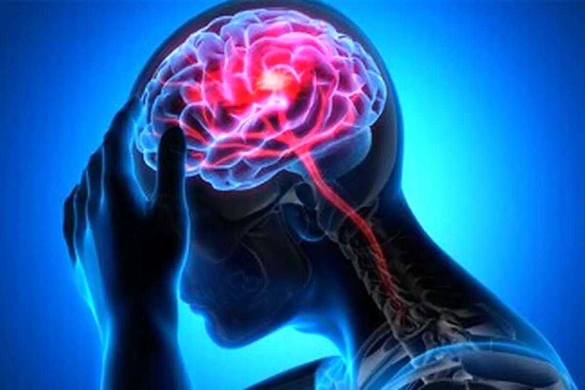 چگونه از سکته مغزی جلوگیری کنیم؟