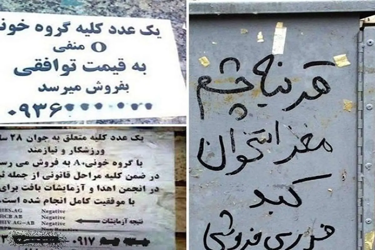 عراقیها خریدار «کلیه» ایرانیان به قیمت دلار!