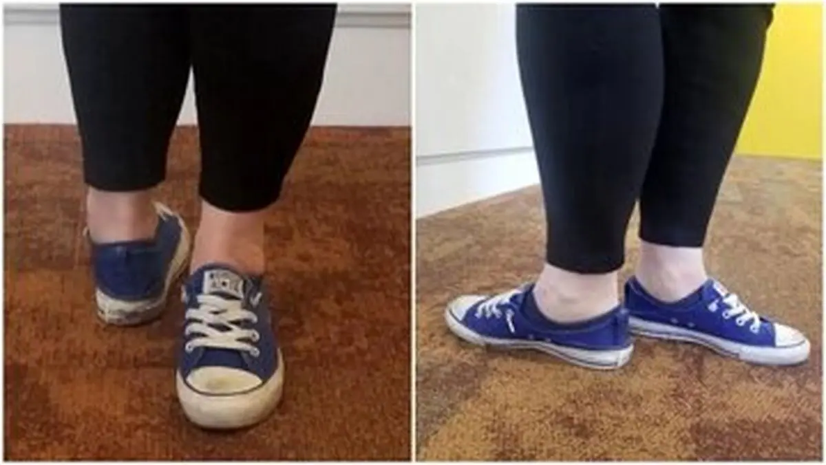 (عکس) این زن می‌تواند پای خود را تا ۱۷۱/۴ درجه بچرخاند