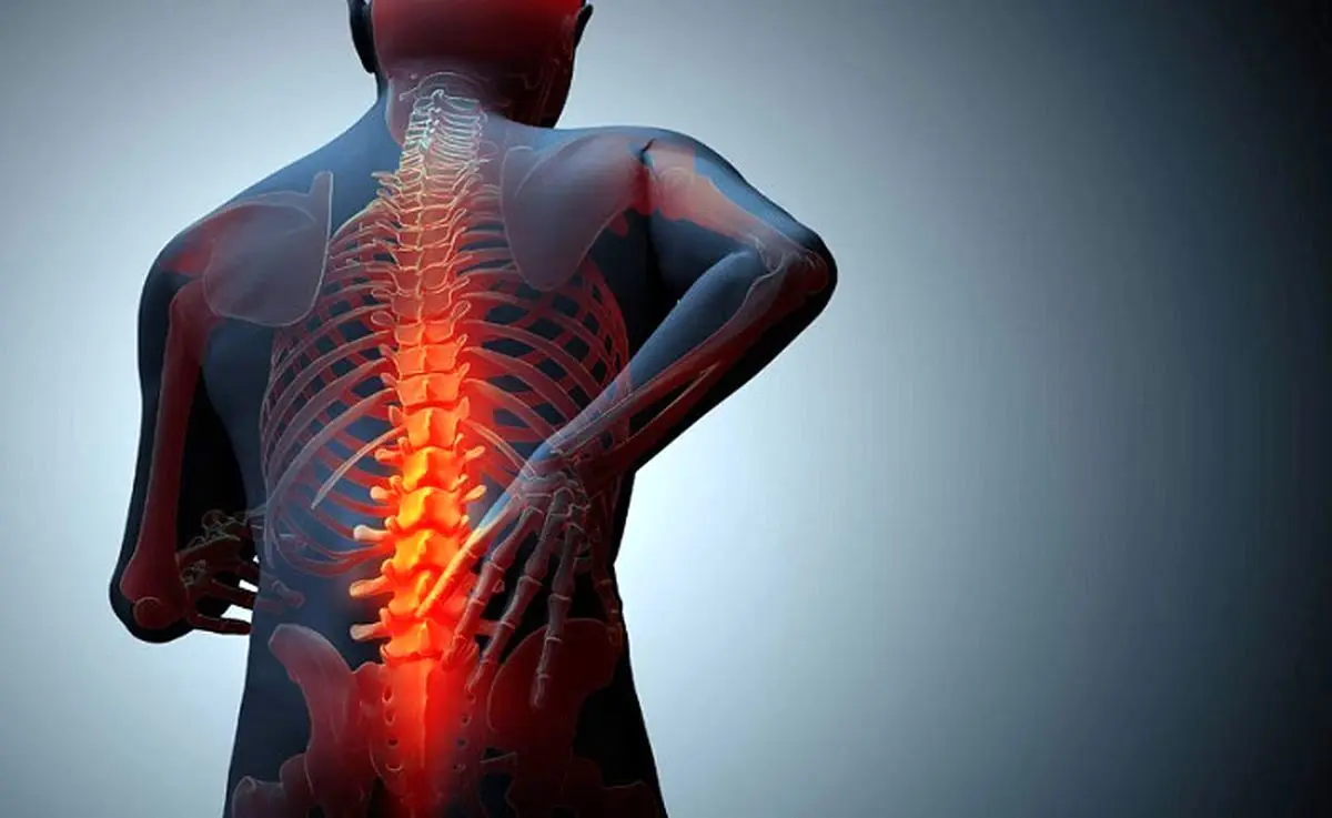 شایع‌ترین علائم تنگی کانال کدامند؟