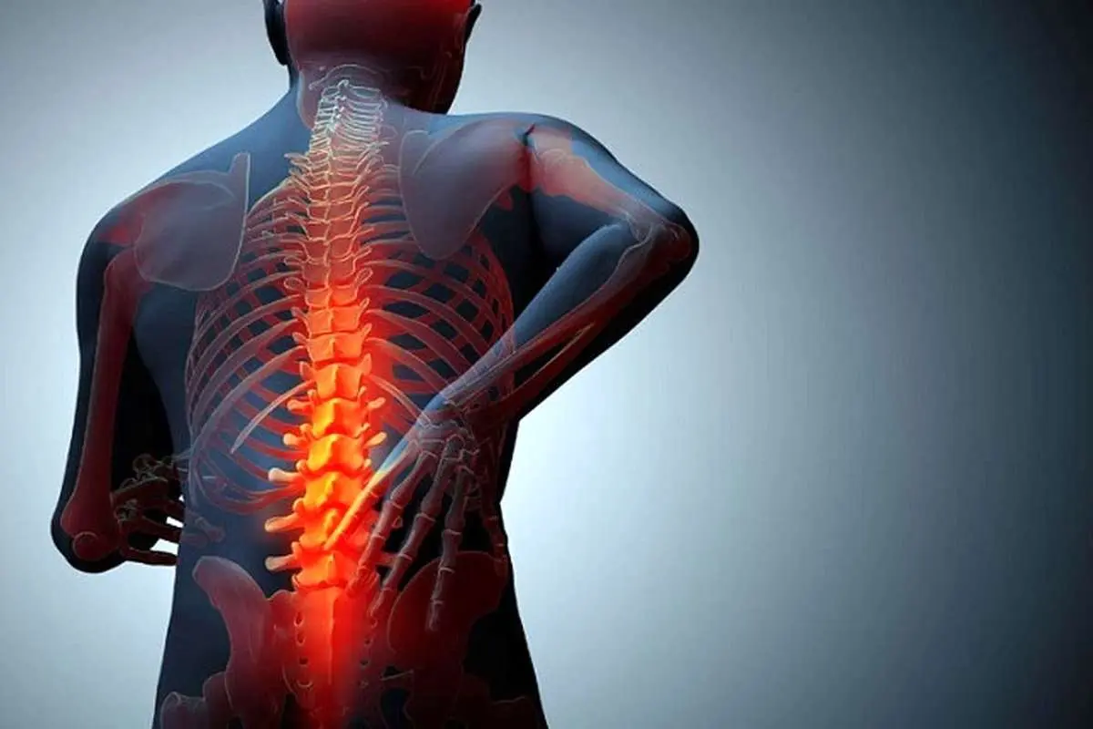شایعترین علائم تنگی کانال کدامند؟