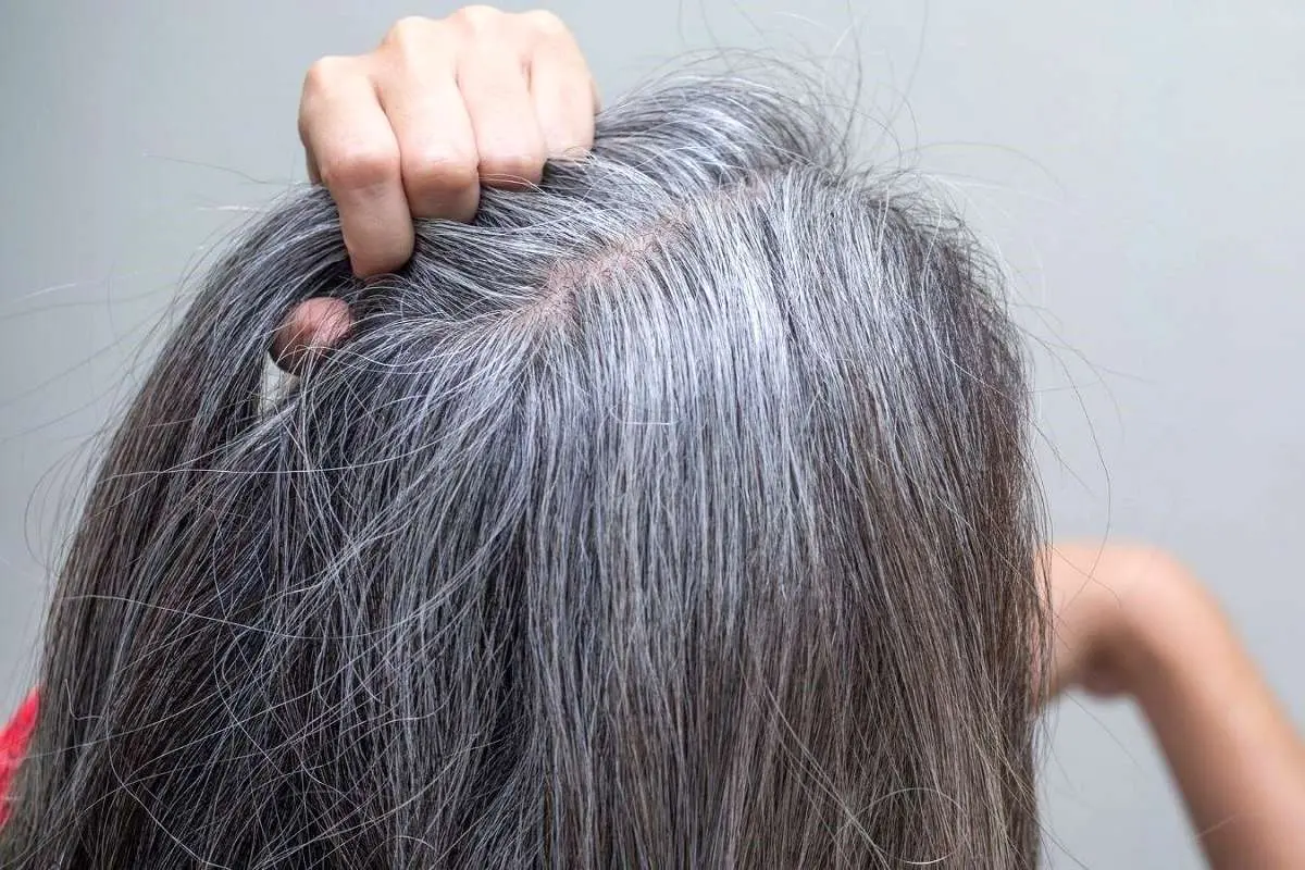 کمبود چه ماده غذایی در بدن باعث سفید شدن موها میشود؟
