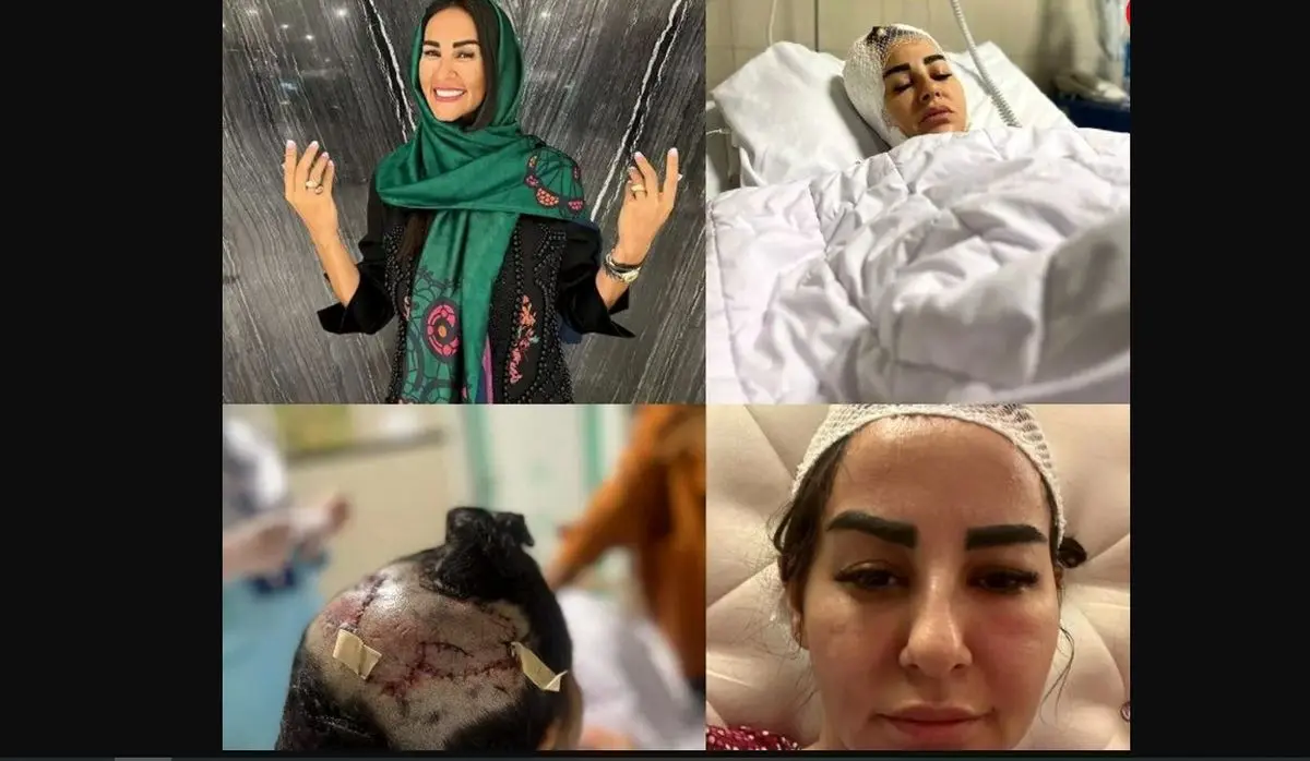 حمله خونین سگ لاکچری به زن همسایه/ زن آرایشگر، شامگاه در شهرک غرب غافلگیر شد