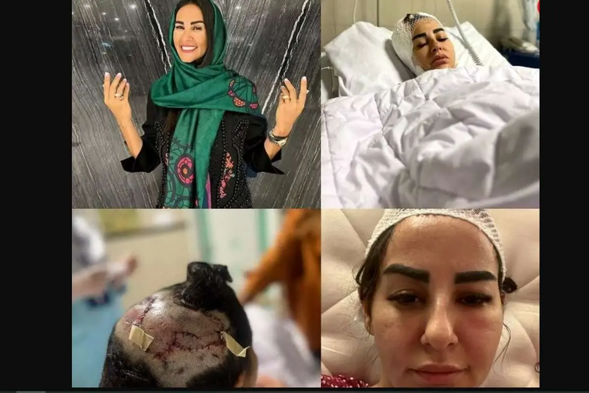 حمله خونین سگ لاکچری به زن همسایه/ زن آرایشگر، شامگاه در شهرک غرب غافلگیر شد