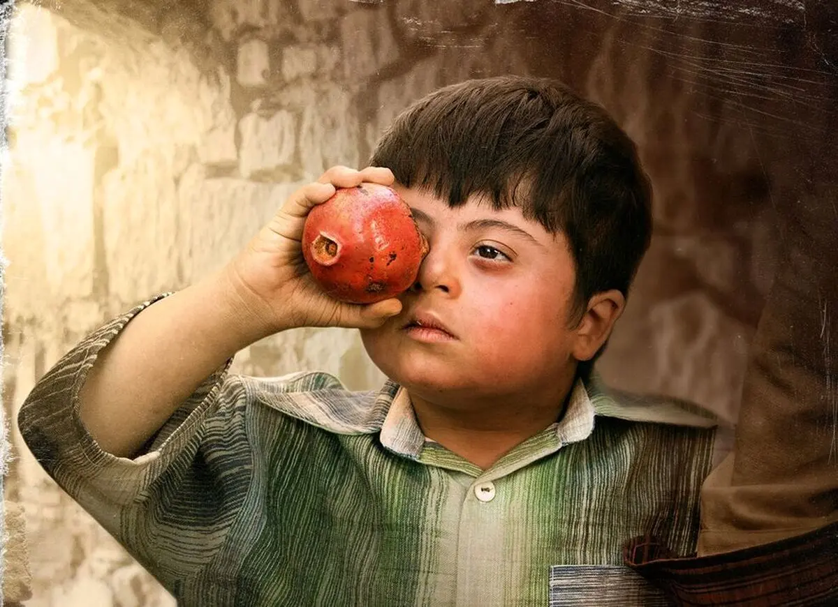 سریال رهایم کن؛ خدمتی که به کودکان سندروم داون کرد