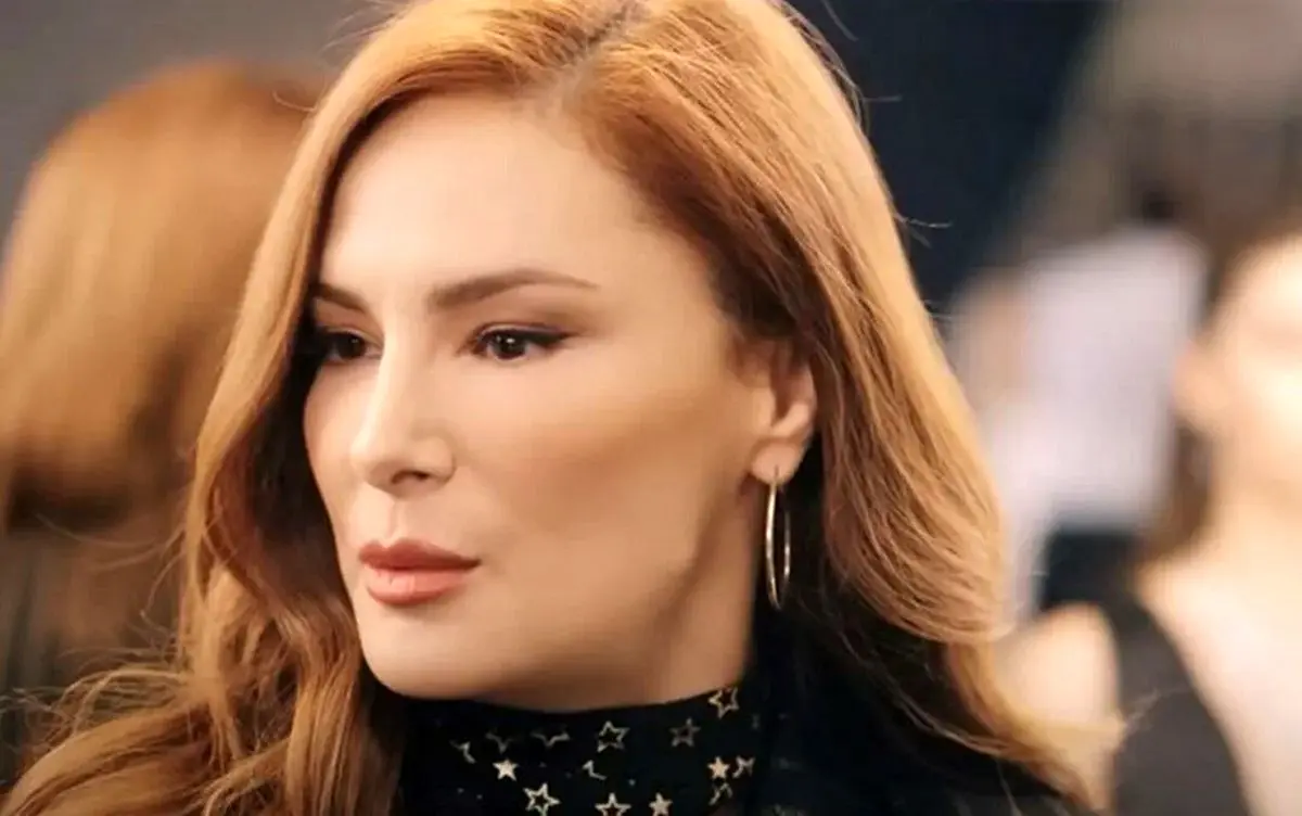 (تصاویر) چه بلایی بر سر چهره زیبای بازیگر مشهور ترک آمده؟