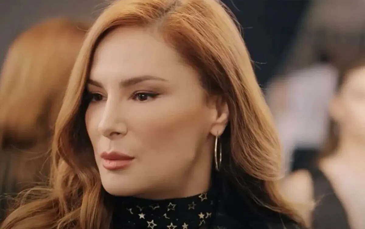 (تصاویر) چه بلایی بر سر چهره زیبای بازیگر مشهور ترک آمده؟