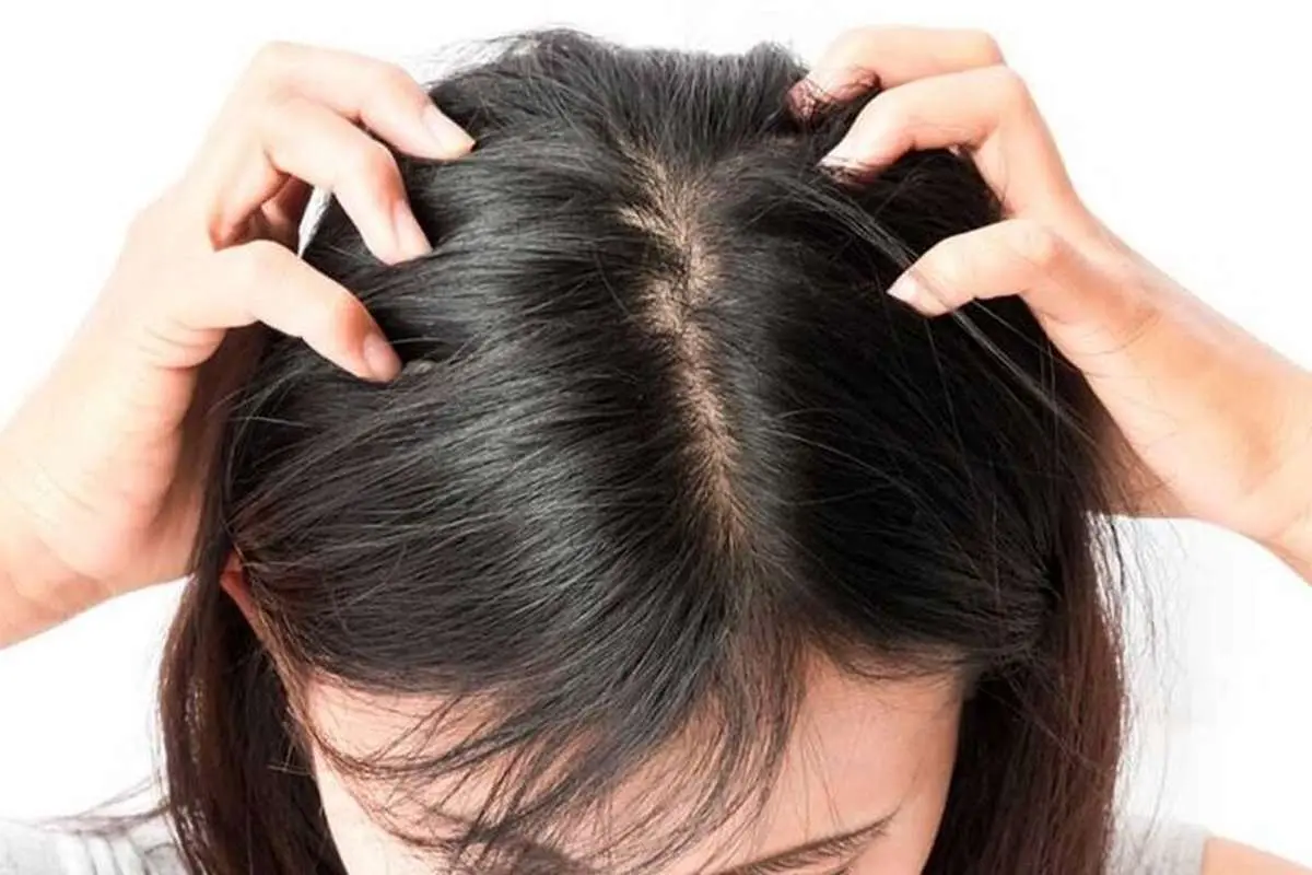 آیا ماساژ پوست سر باعث رشد موها میشود؟