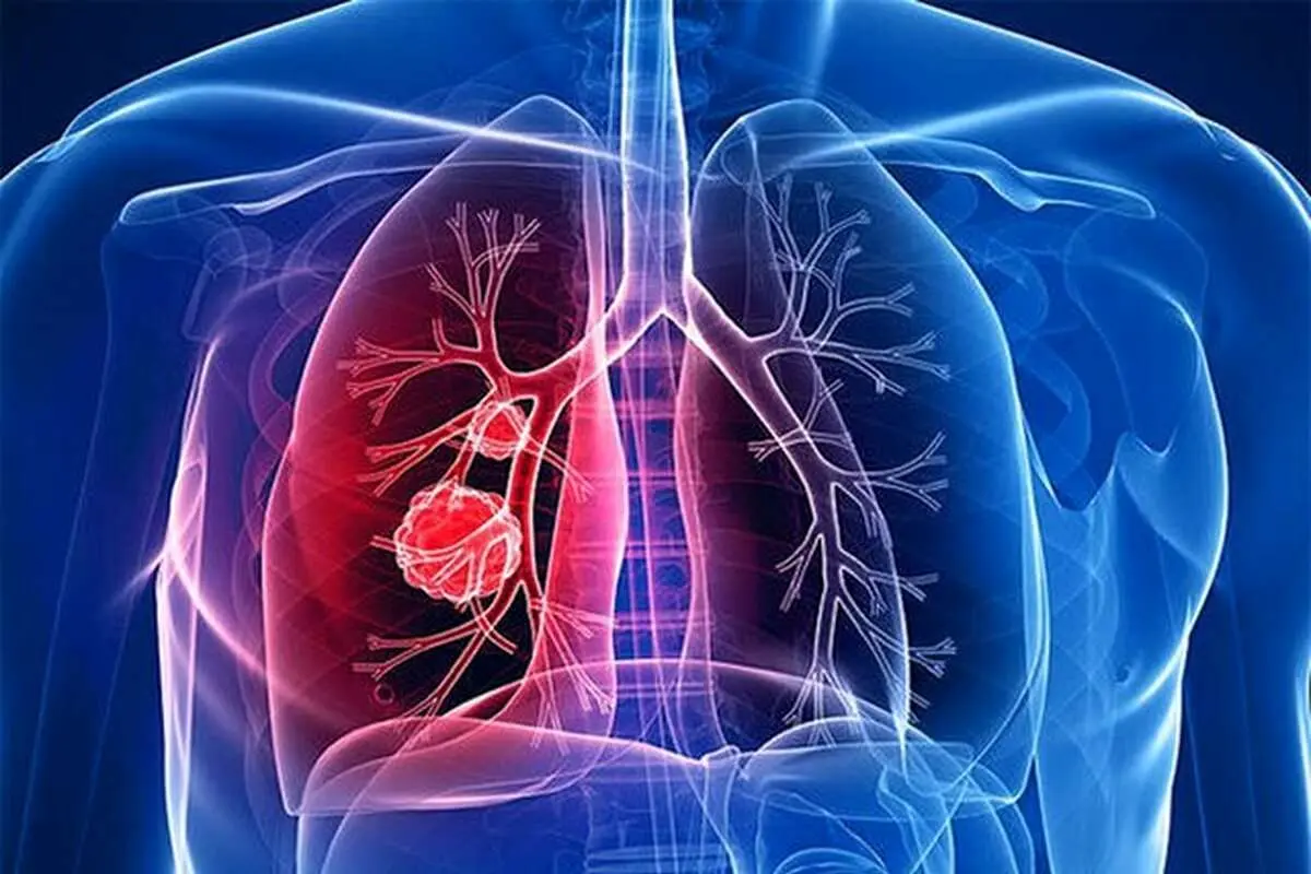 کمبود اکسیژن باعث افزایش طول عمر میشود