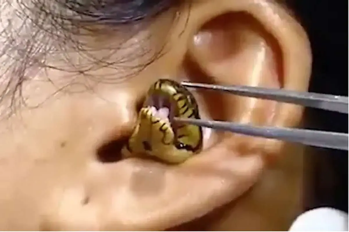 (ویدئو) مار زندهای که در گوش یک زن گیرافتاد؛ چرا باید مراقب فیلمهای ویروسی باشیم؟