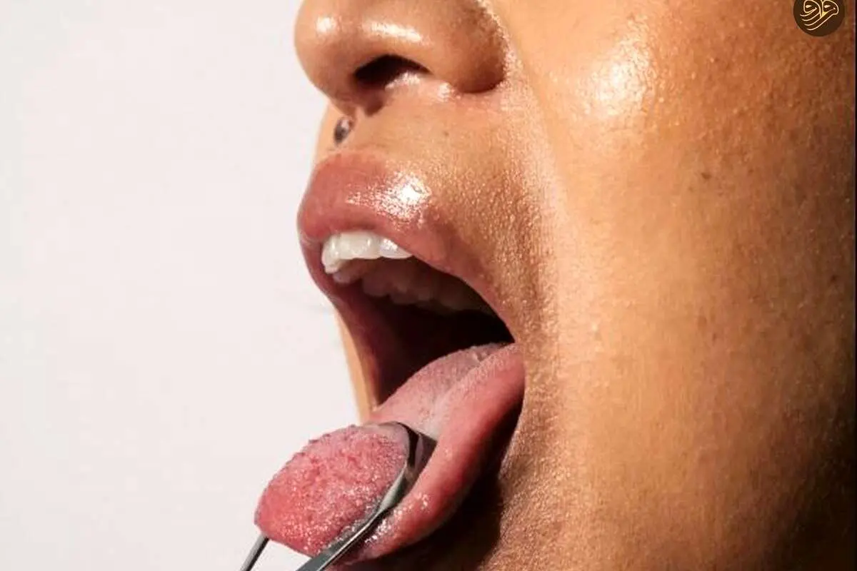 آیا برداشتن لایه روی زبان مفید است؟