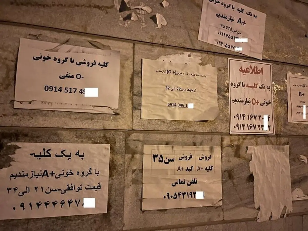 عضو بدن شما را خریداریم! / فروش دلاری «کلیه»  ایرانی‌ها با سفر به ترکیه و عراق!