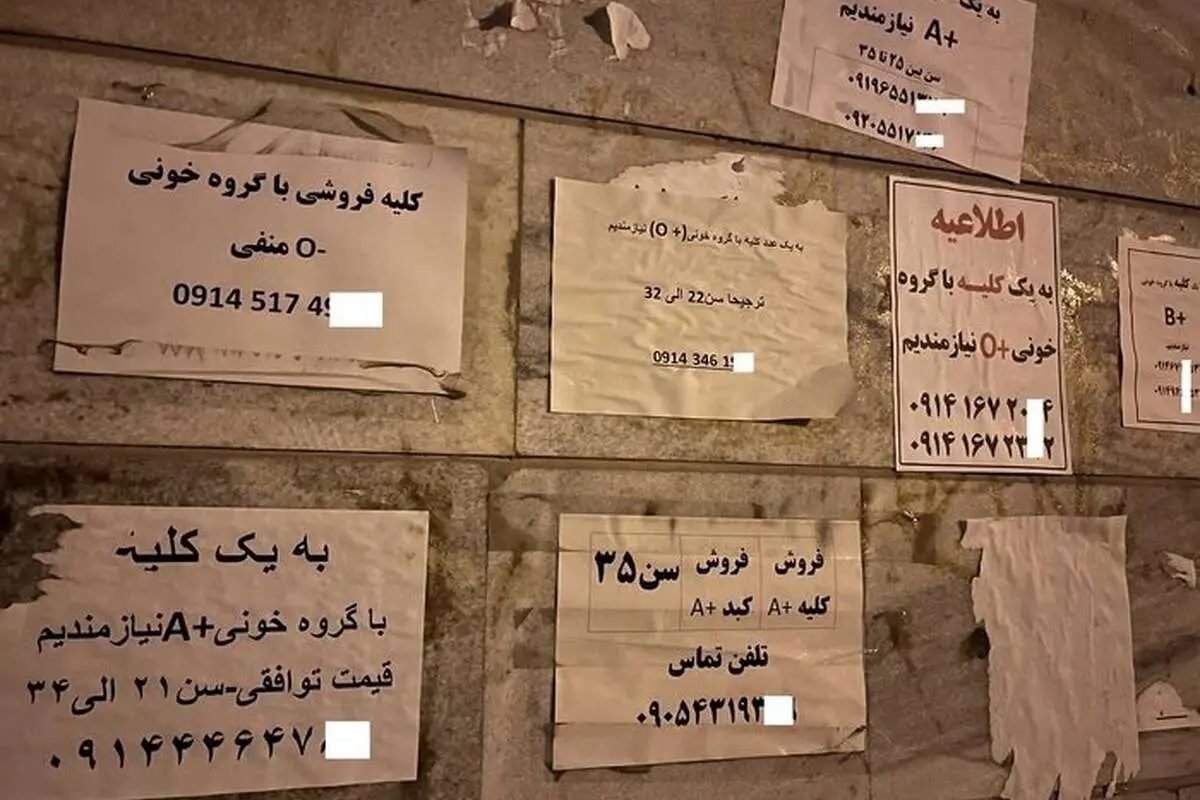 عضو بدن شما را خریداریم! / فروش دلاری «کلیه» ایرانیها با سفر به ترکیه و عراق!