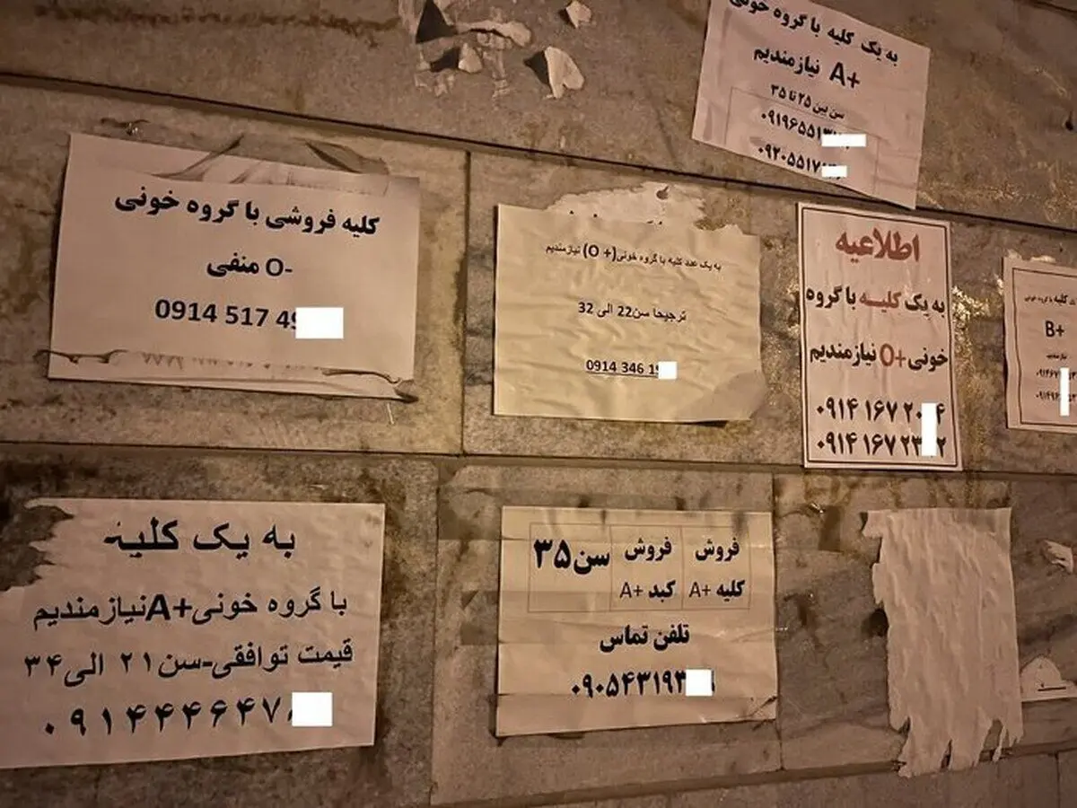 عضو بدن شما را خریداریم! / فروش دلاری «کلیه»  ایرانی‌ها با سفر به ترکیه و عراق!