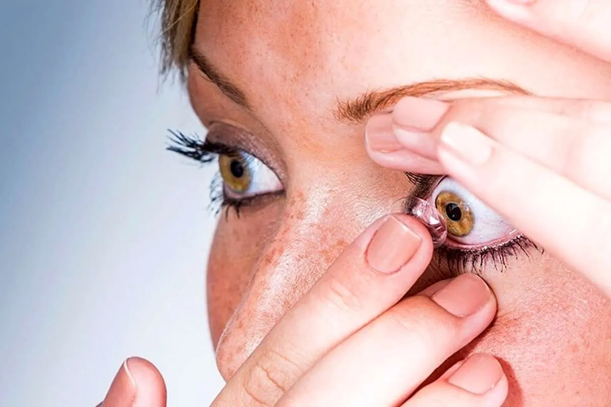 عوارض خطرناک لنز‌های اجاره‌ای