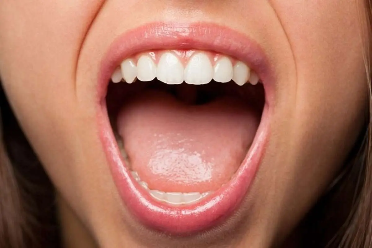 (عکس) چه چیزی باعث ایجاد خط سفید داخل گونه‌ها می‌شود؟