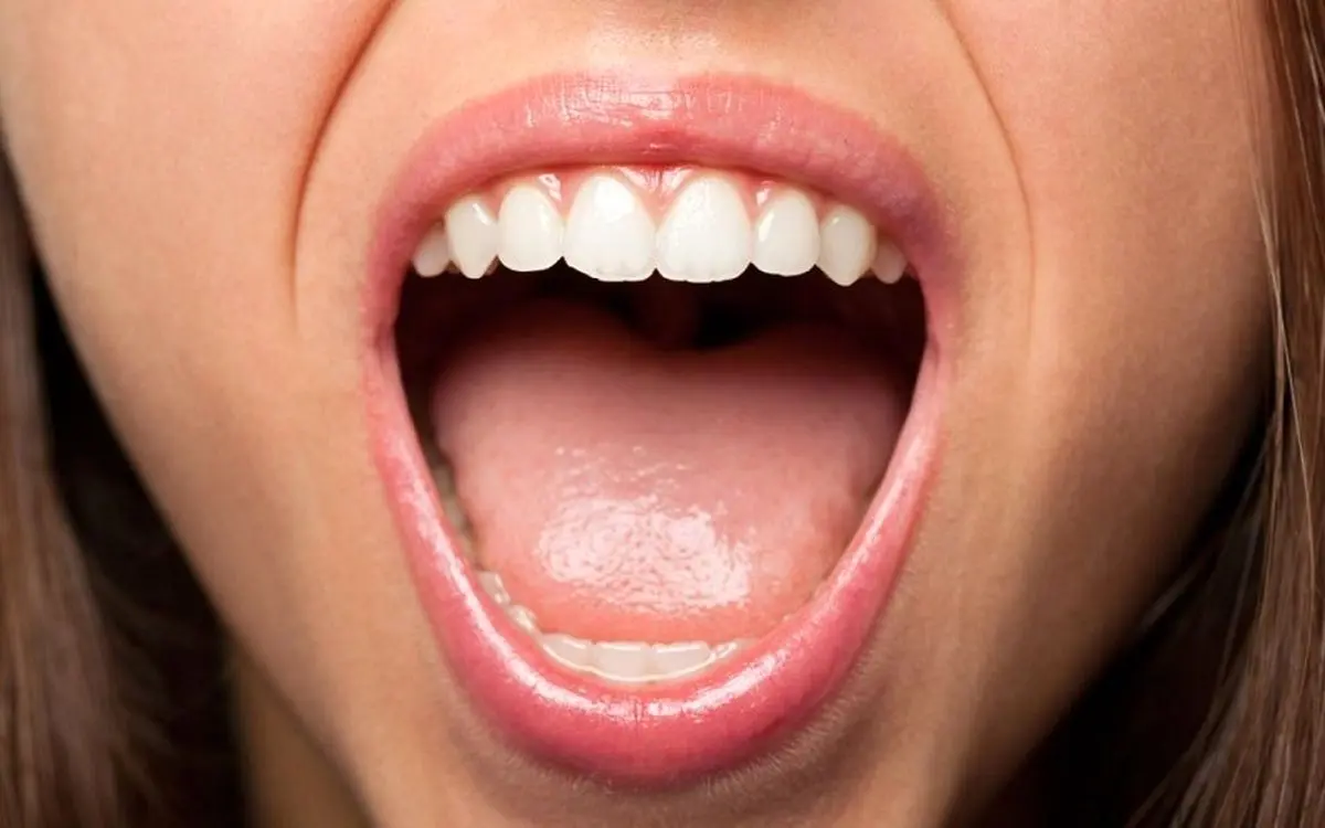 (عکس) چه چیزی باعث ایجاد خط سفید داخل گونه‌ها می‌شود؟